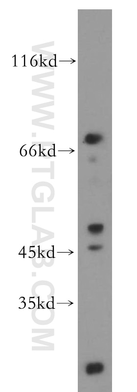 Western Blot (WB) analysis of Raji cells using DDX51 Polyclonal antibody (20149-1-AP)