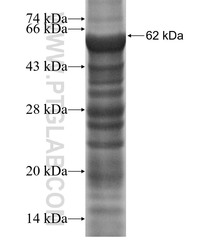 DDX51 fusion protein Ag13691 SDS-PAGE