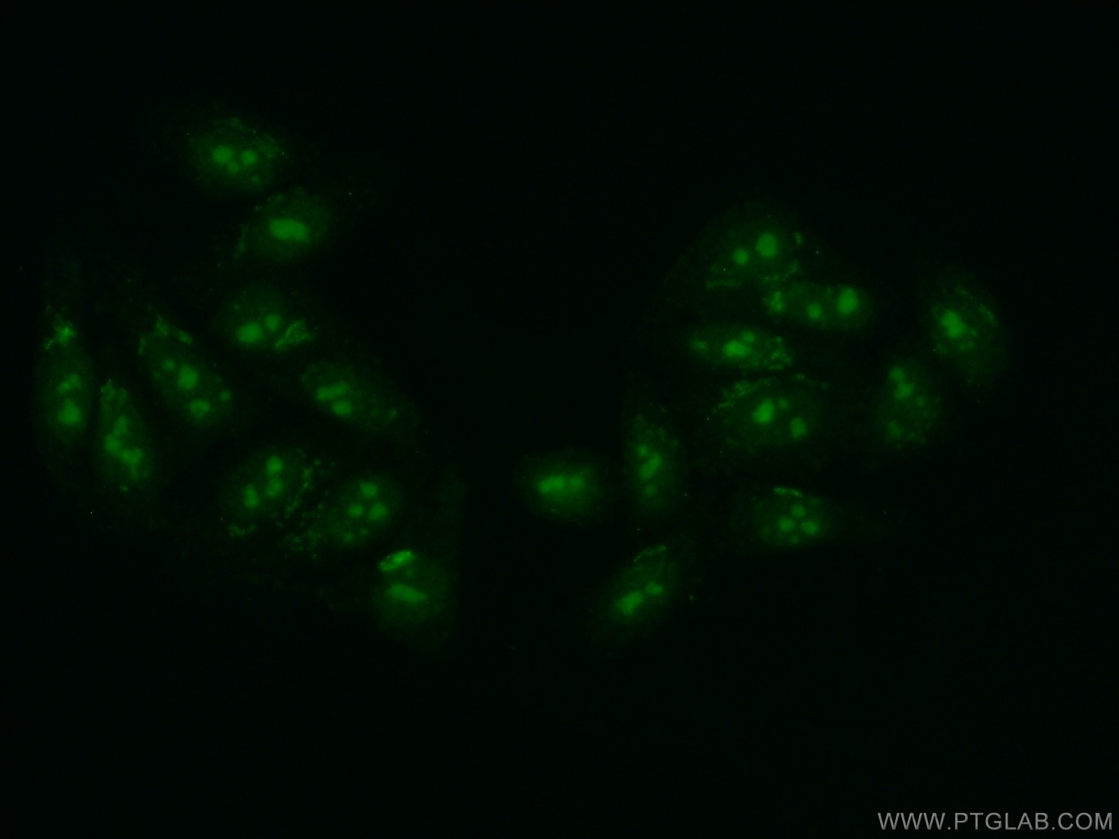 Immunofluorescence (IF) / fluorescent staining of HepG2 cells using DDX52 Polyclonal antibody (16660-1-AP)