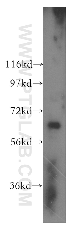 Western Blot (WB) analysis of Jurkat cells using DDX52 Polyclonal antibody (16660-1-AP)