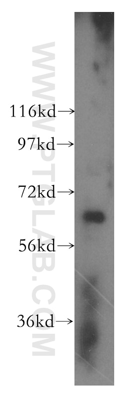 WB analysis of Jurkat using 16660-1-AP
