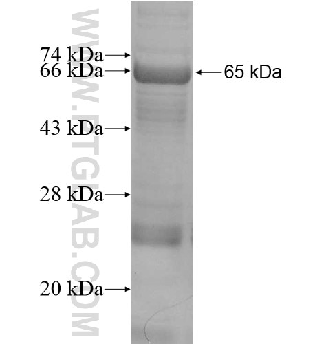 DDX52 fusion protein Ag10118 SDS-PAGE