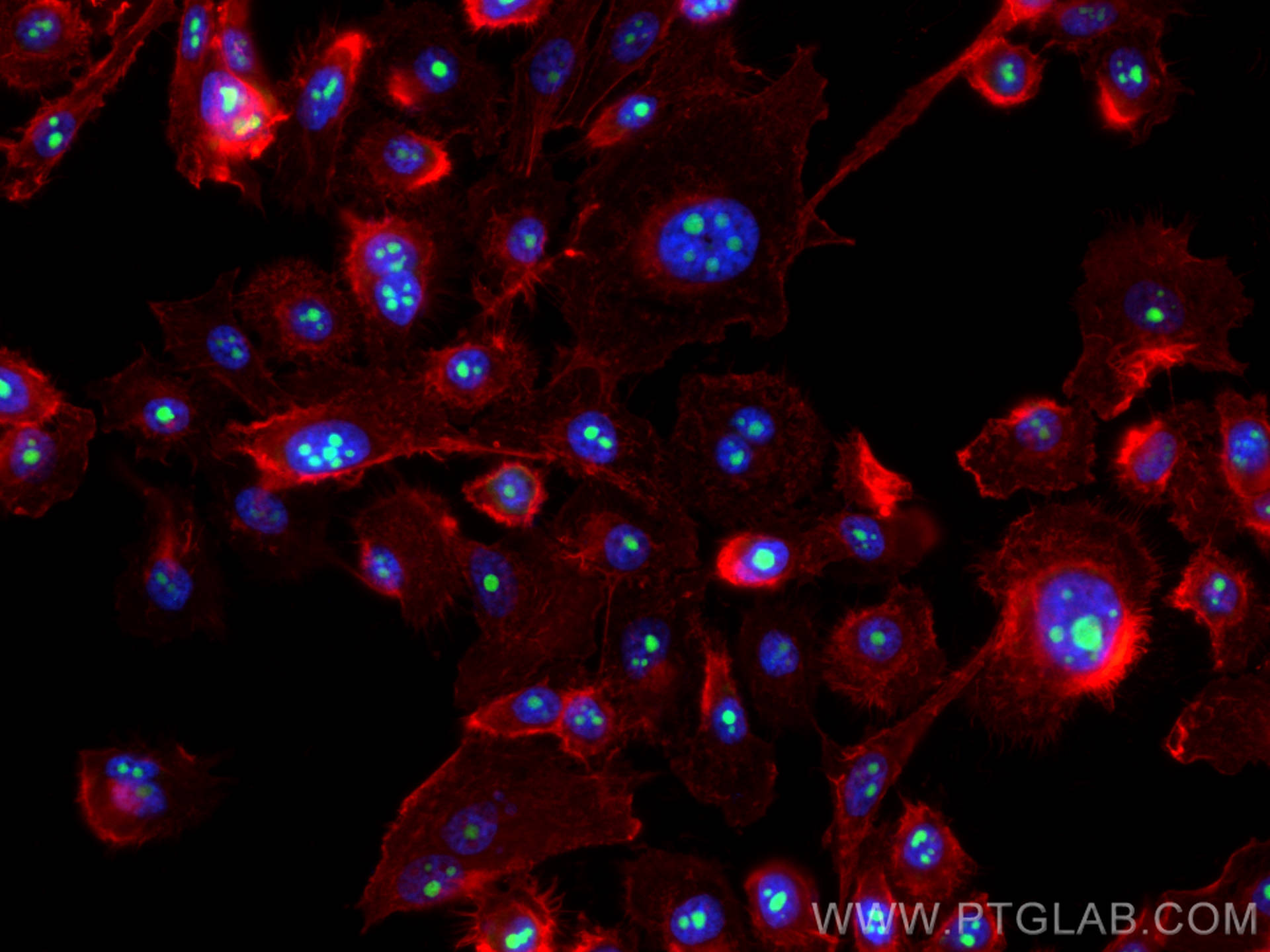 Immunofluorescence (IF) / fluorescent staining of PC-3 cells using DDX54 Polyclonal antibody (26894-1-AP)