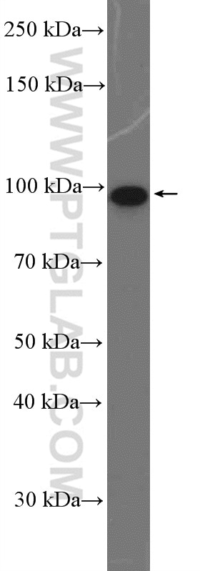 Western Blot (WB) analysis of HeLa cells using DDX54 Polyclonal antibody (26894-1-AP)