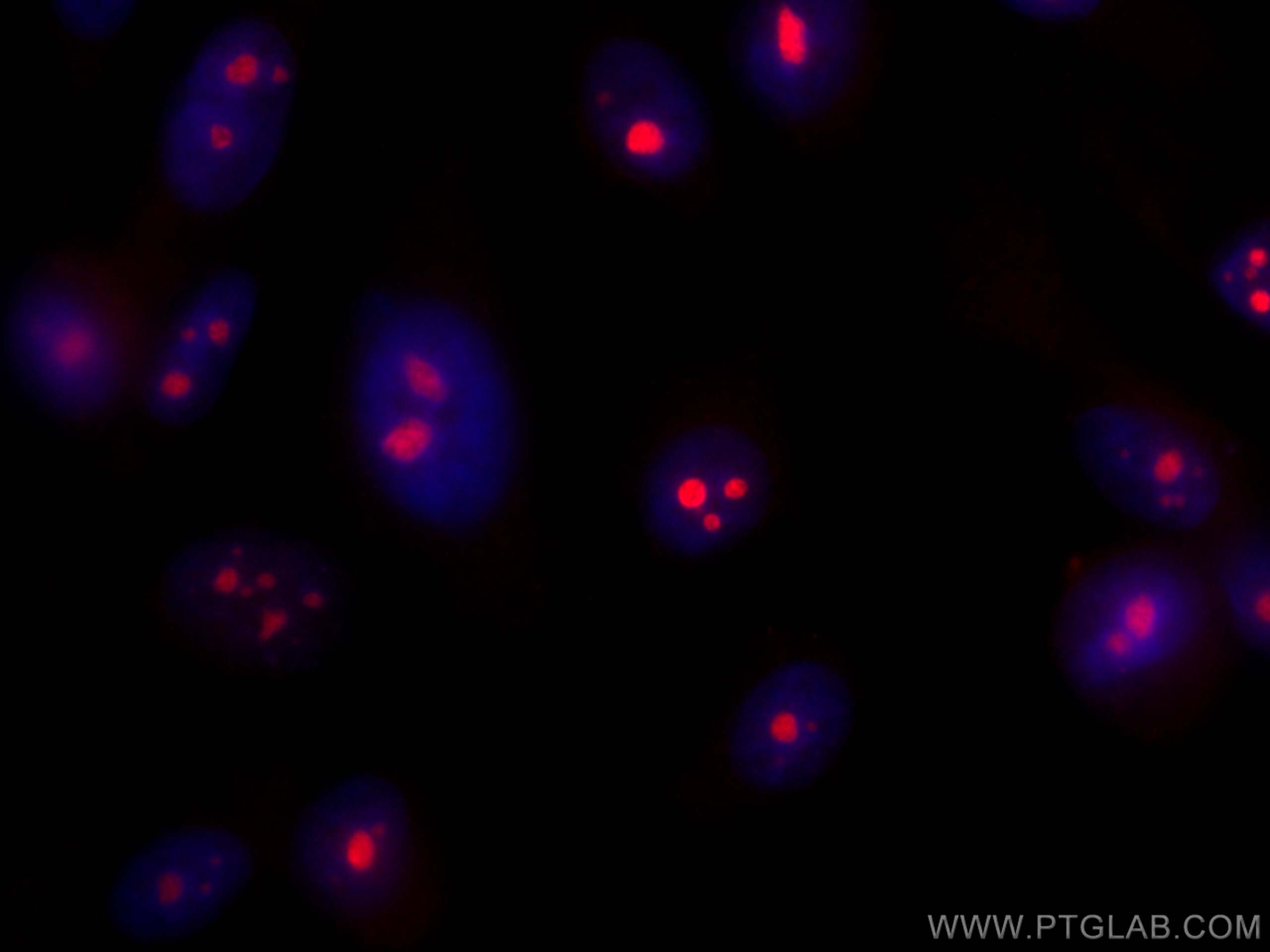 Immunofluorescence (IF) / fluorescent staining of PC-3 cells using CoraLite®594-conjugated DDX54 Monoclonal antibody (CL594-66664)