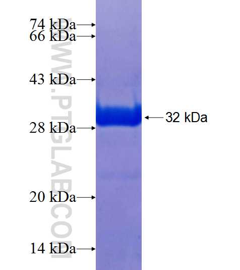 DDX54 fusion protein Ag25289 SDS-PAGE