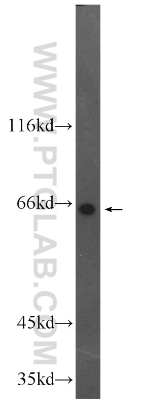 Western Blot (WB) analysis of HepG2 cells using DDX56 Polyclonal antibody (21989-1-AP)