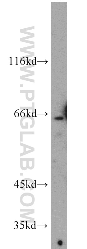 Western Blot (WB) analysis of mouse brain tissue using DDX56 Polyclonal antibody (21989-1-AP)