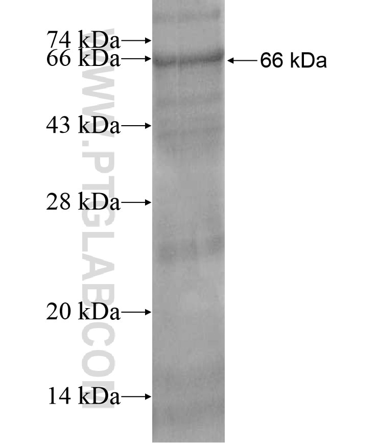 DDX56 fusion protein Ag17272 SDS-PAGE