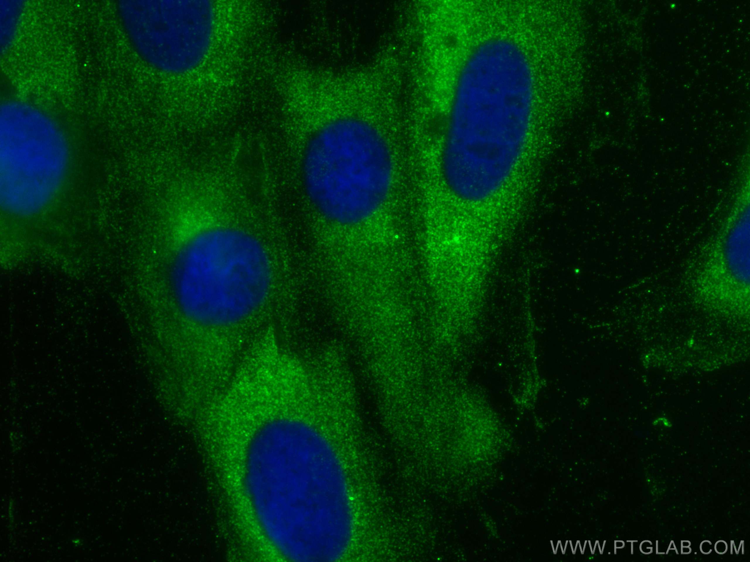 Immunofluorescence (IF) / fluorescent staining of H9C2 cells using RIG-1/DDX58 Polyclonal antibody (20566-1-AP)