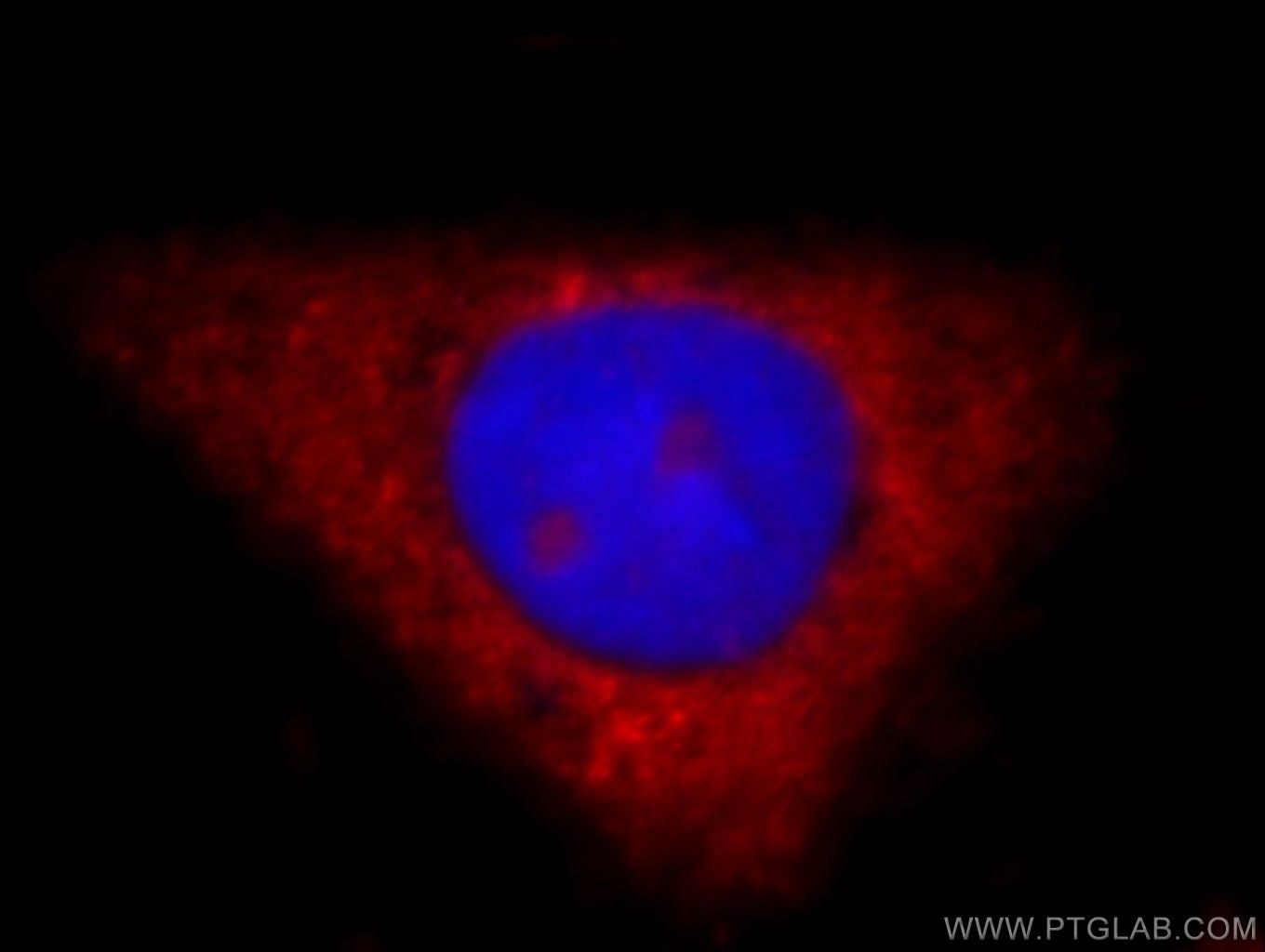 Immunofluorescence (IF) / fluorescent staining of HepG2 cells using RIG-1/DDX58 Polyclonal antibody (20566-1-AP)