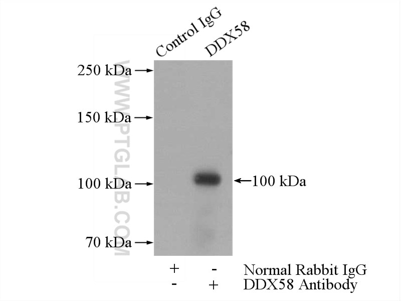 Immunoprecipitation (IP) experiment of HepG2 cells using RIG-1/DDX58 Polyclonal antibody (20566-1-AP)