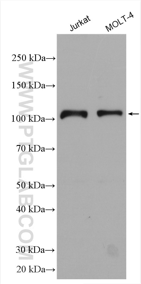 Western Blot (WB) analysis of various lysates using RIG-1/DDX58 Polyclonal antibody (20566-1-AP)