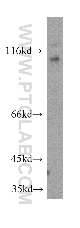 Western Blot (WB) analysis of MCF-7 cells using RIG-1/DDX58 Polyclonal antibody (20566-1-AP)