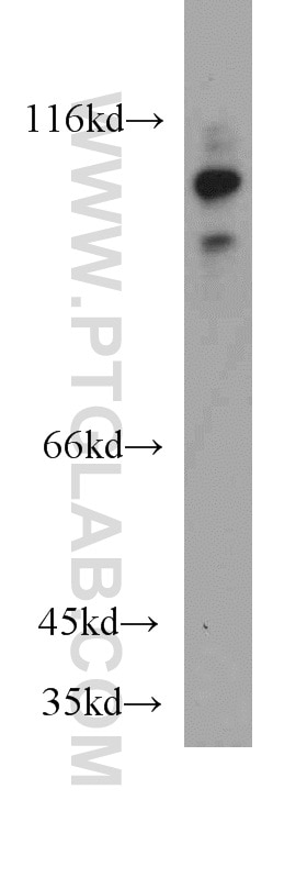 Western Blot (WB) analysis of mouse brain tissue using RIG-1/DDX58 Polyclonal antibody (20566-1-AP)