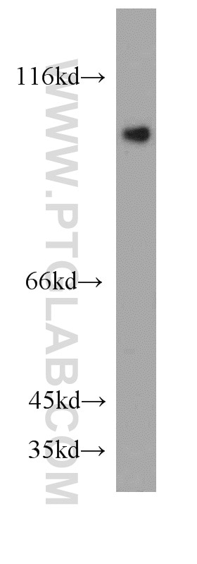 WB analysis of HepG2 using 20566-1-AP