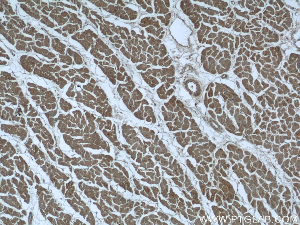 Immunohistochemistry (IHC) staining of human heart tissue using RIG-1/DDX58 Polyclonal antibody (25068-1-AP)