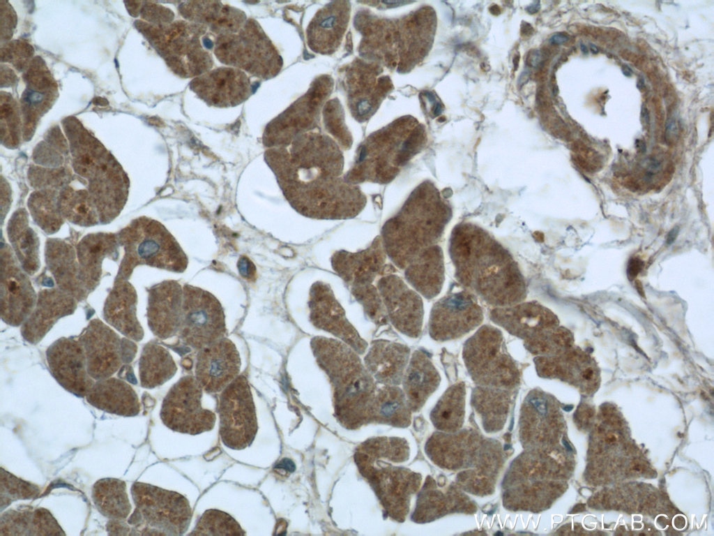 Immunohistochemistry (IHC) staining of human heart tissue using RIG-1/DDX58 Polyclonal antibody (25068-1-AP)