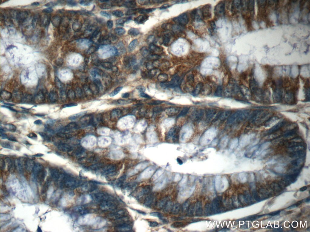 Immunohistochemistry (IHC) staining of human colon tissue using RIG-1/DDX58 Polyclonal antibody (25068-1-AP)