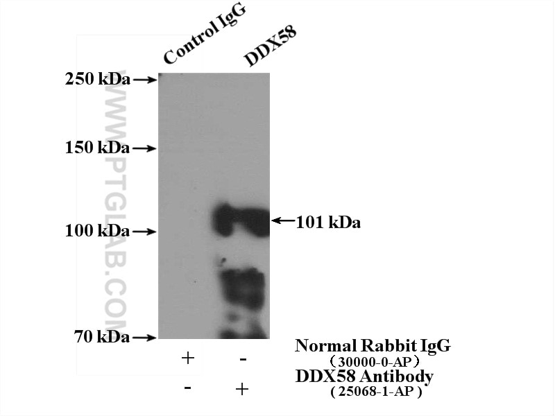 Immunoprecipitation (IP) experiment of A431 cells using RIG-1/DDX58 Polyclonal antibody (25068-1-AP)