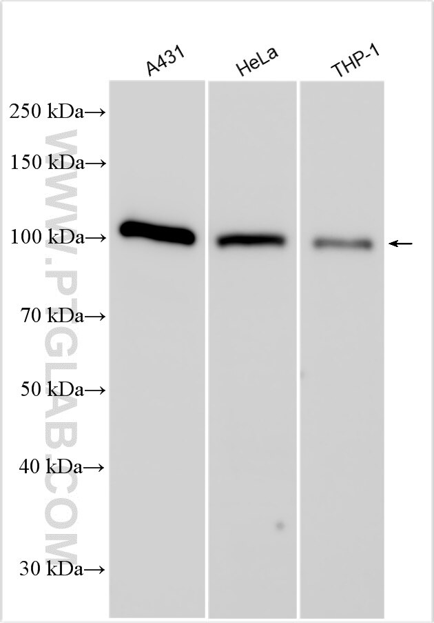 Western Blot (WB) analysis of various lysates using RIG-1/DDX58 Polyclonal antibody (25068-1-AP)