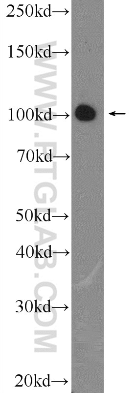 Western Blot (WB) analysis of A431 cells using RIG-1/DDX58 Polyclonal antibody (25068-1-AP)