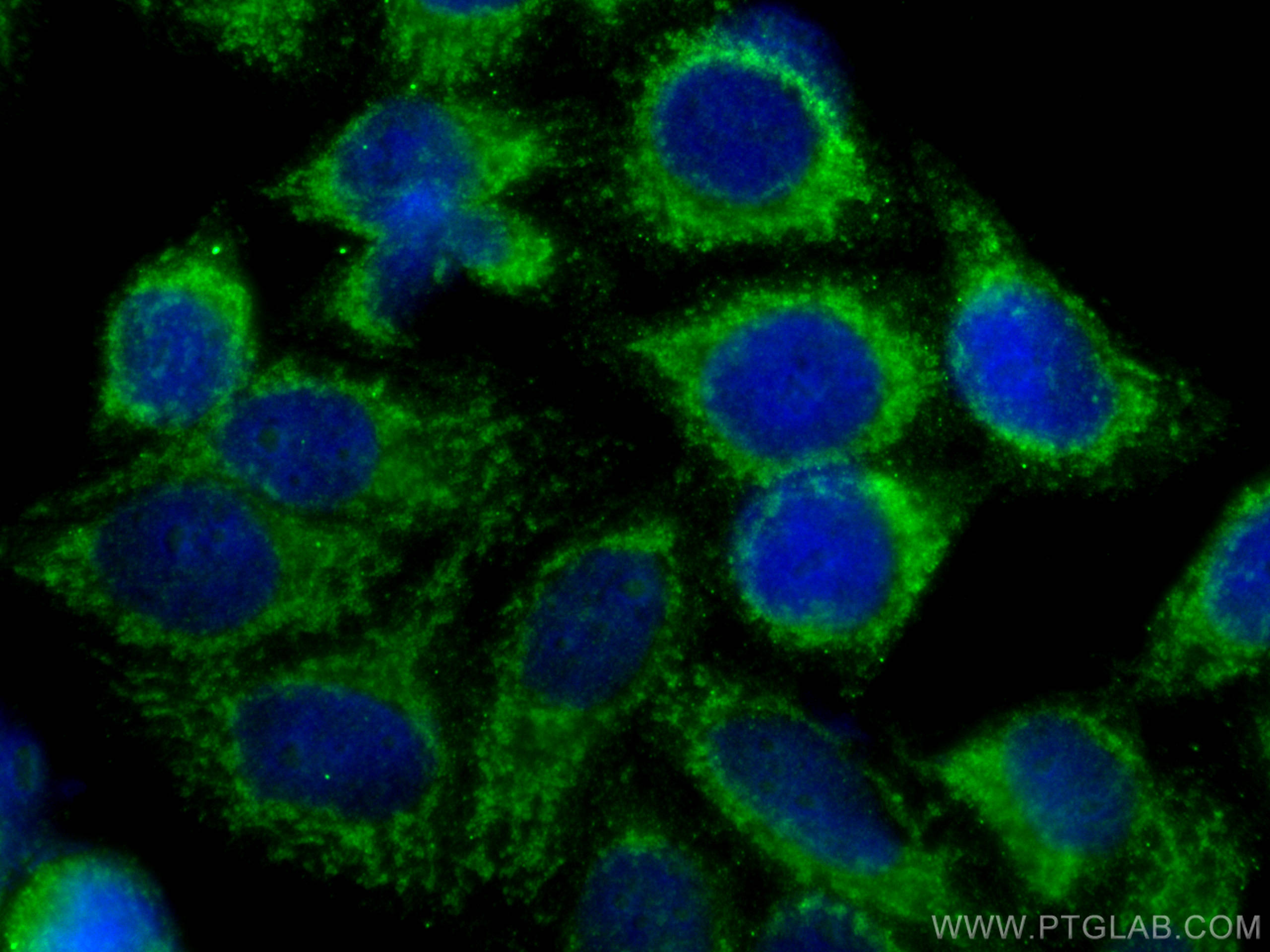 Immunofluorescence (IF) / fluorescent staining of HepG2 cells using RIG-1/DDX58 Monoclonal antibody (67556-1-Ig)