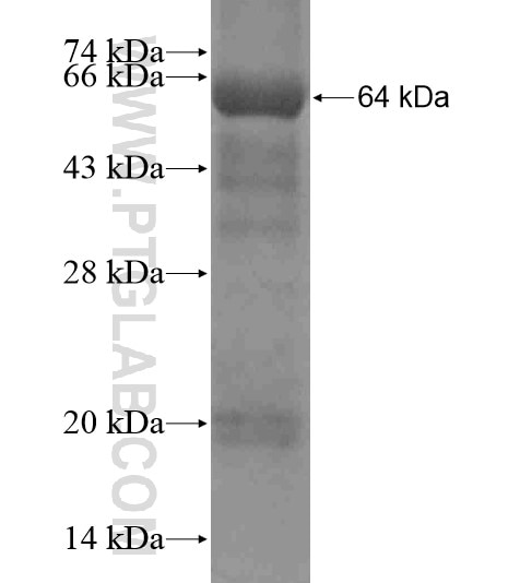 DDX58 fusion protein Ag18585 SDS-PAGE