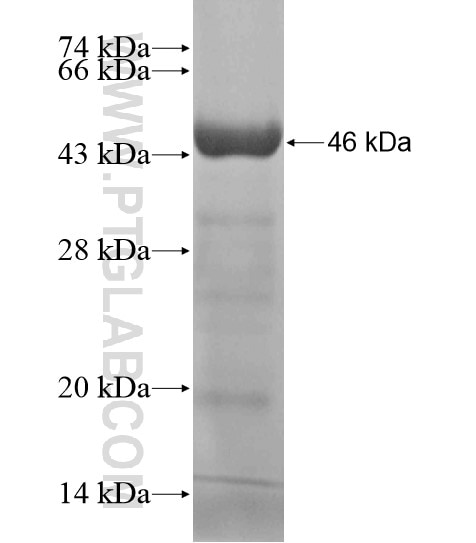 DDX58 fusion protein Ag18591 SDS-PAGE