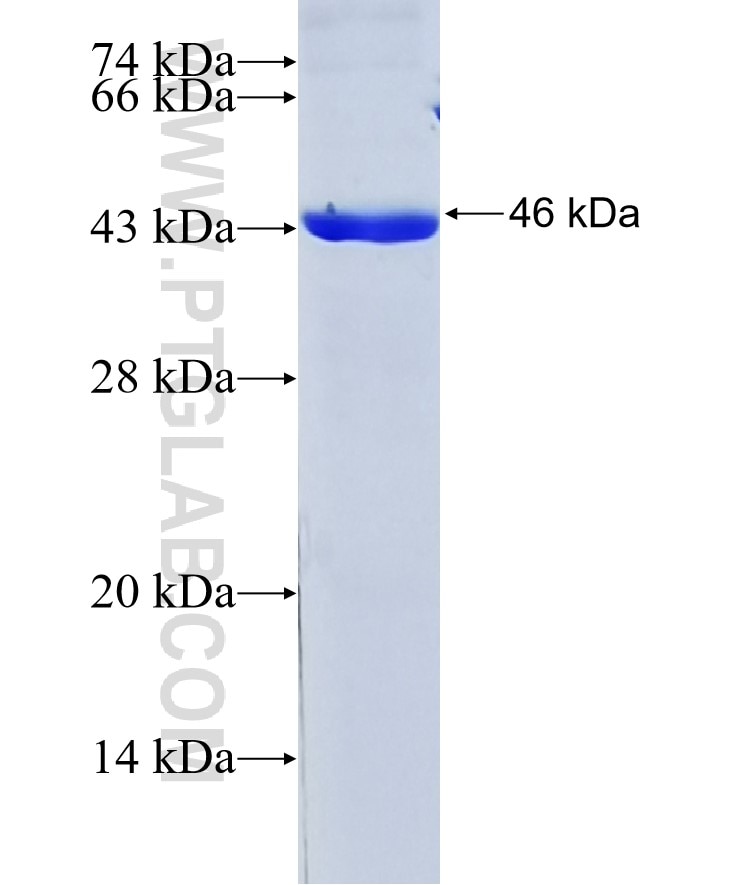 DDX58 fusion protein Ag18591 SDS-PAGE