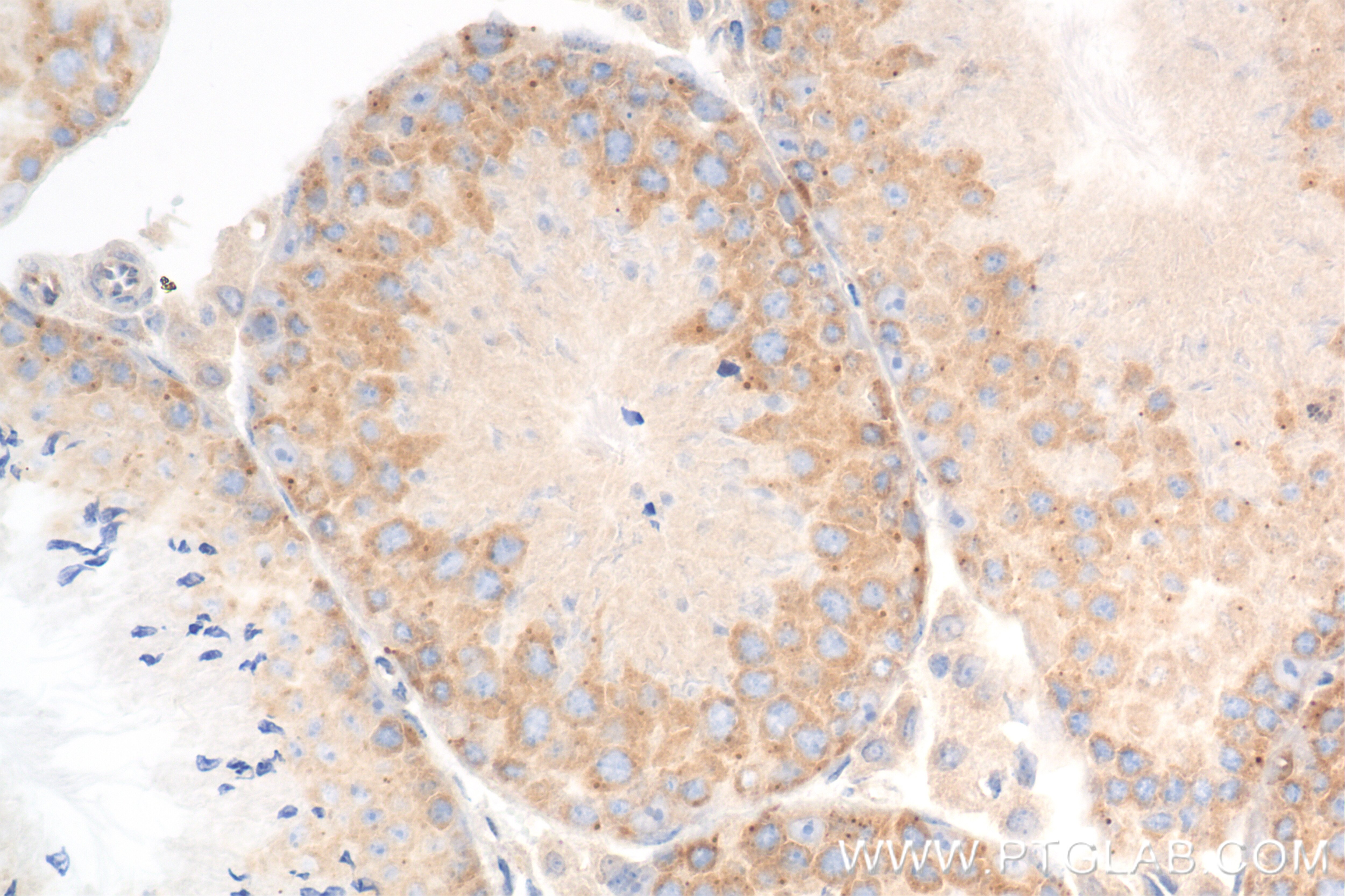 Immunohistochemistry (IHC) staining of mouse testis tissue using DDX6 Recombinant antibody (85686-1-RR)