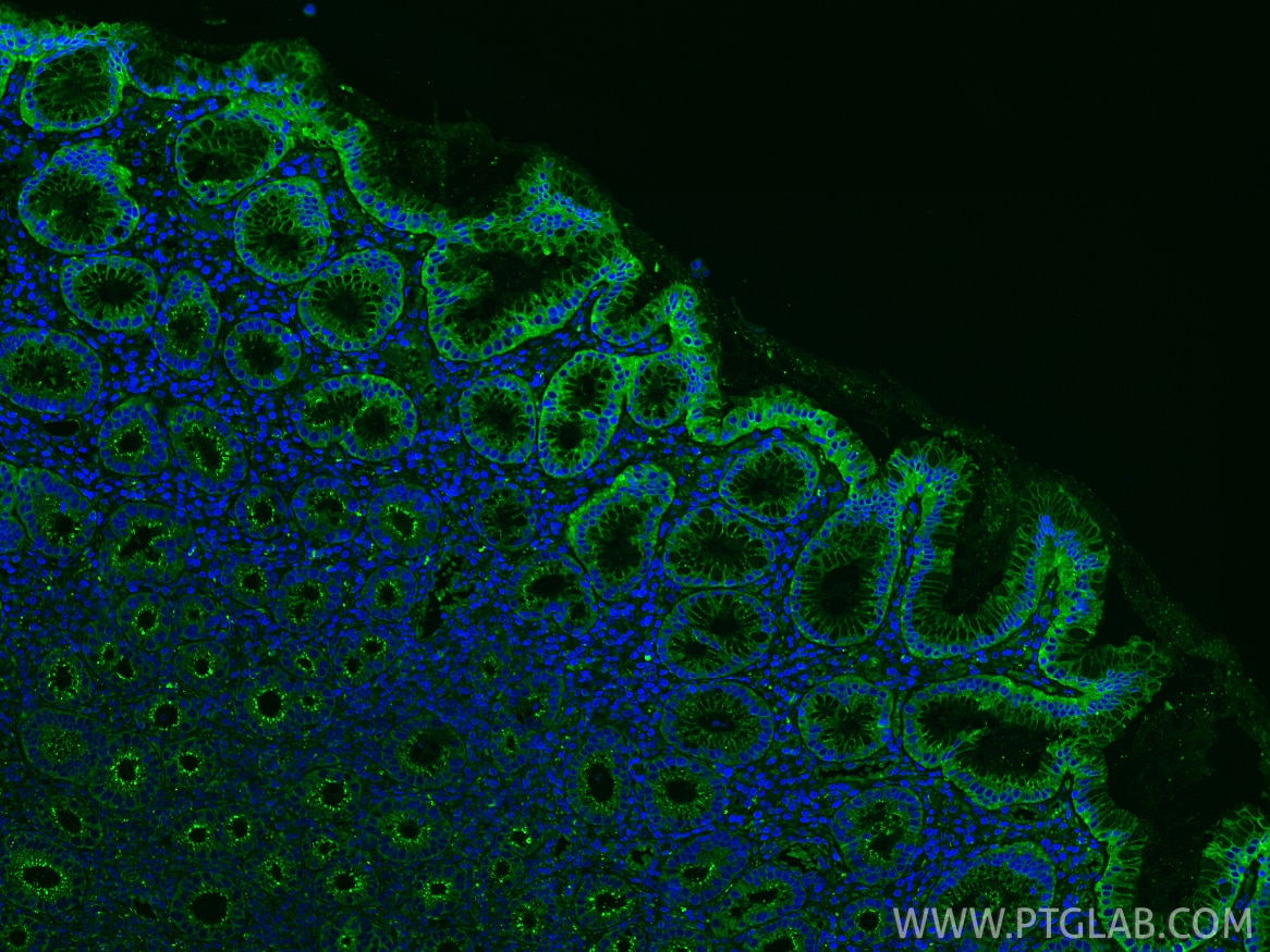 Immunofluorescence (IF) / fluorescent staining of human stomach tissue using DDX60 Polyclonal antibody (30982-1-AP)