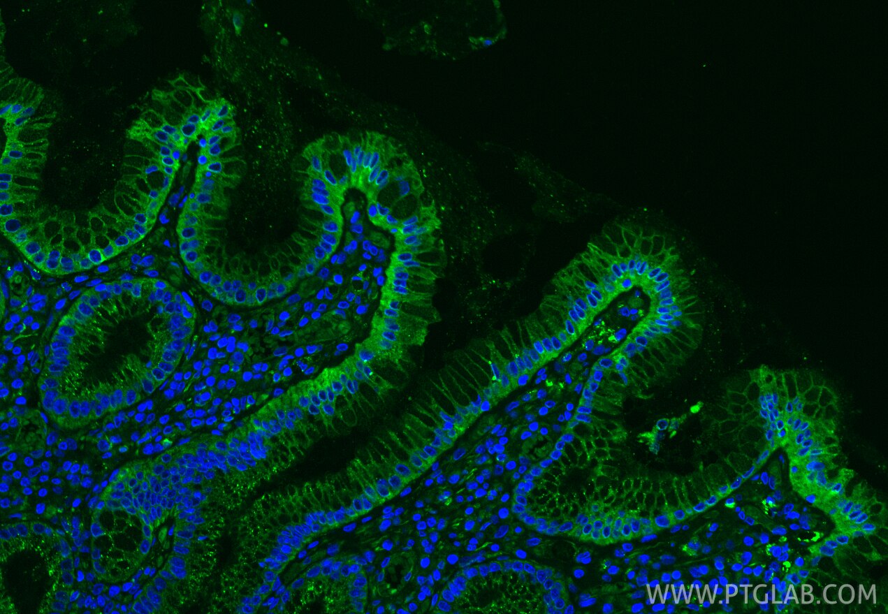 Immunofluorescence (IF) / fluorescent staining of human stomach tissue using DDX60 Polyclonal antibody (30982-1-AP)