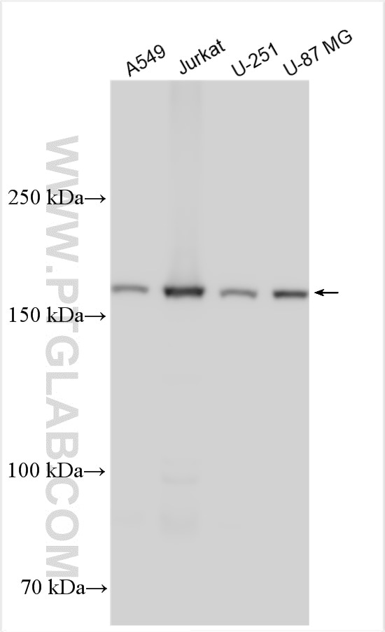 Western Blot (WB) analysis of various lysates using DDX60 Polyclonal antibody (30982-1-AP)