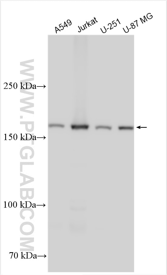 WB analysis using 30982-1-AP