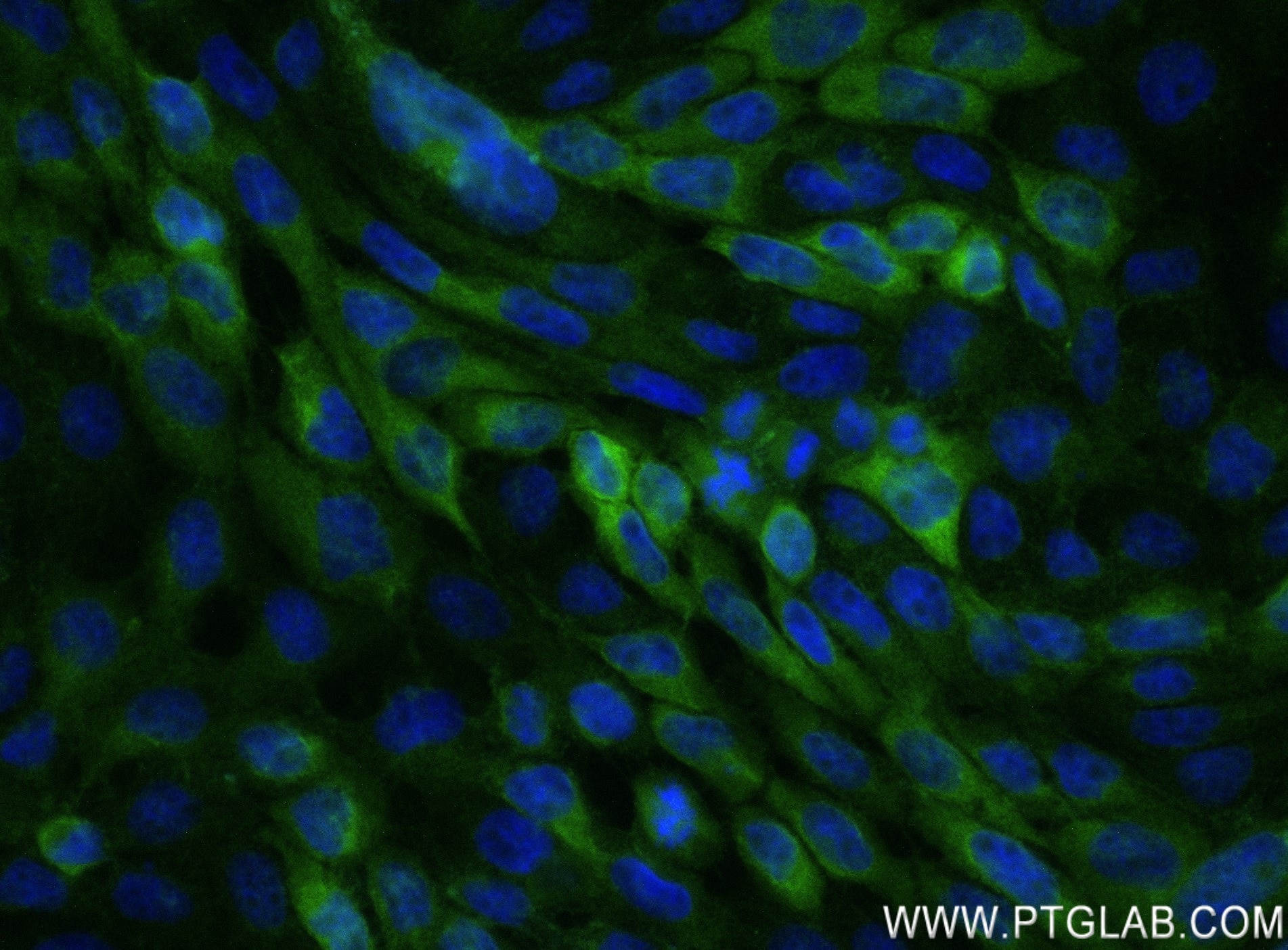 Immunofluorescence (IF) / fluorescent staining of A431 cells using DDX60 Recombinant antibody (82969-1-RR)