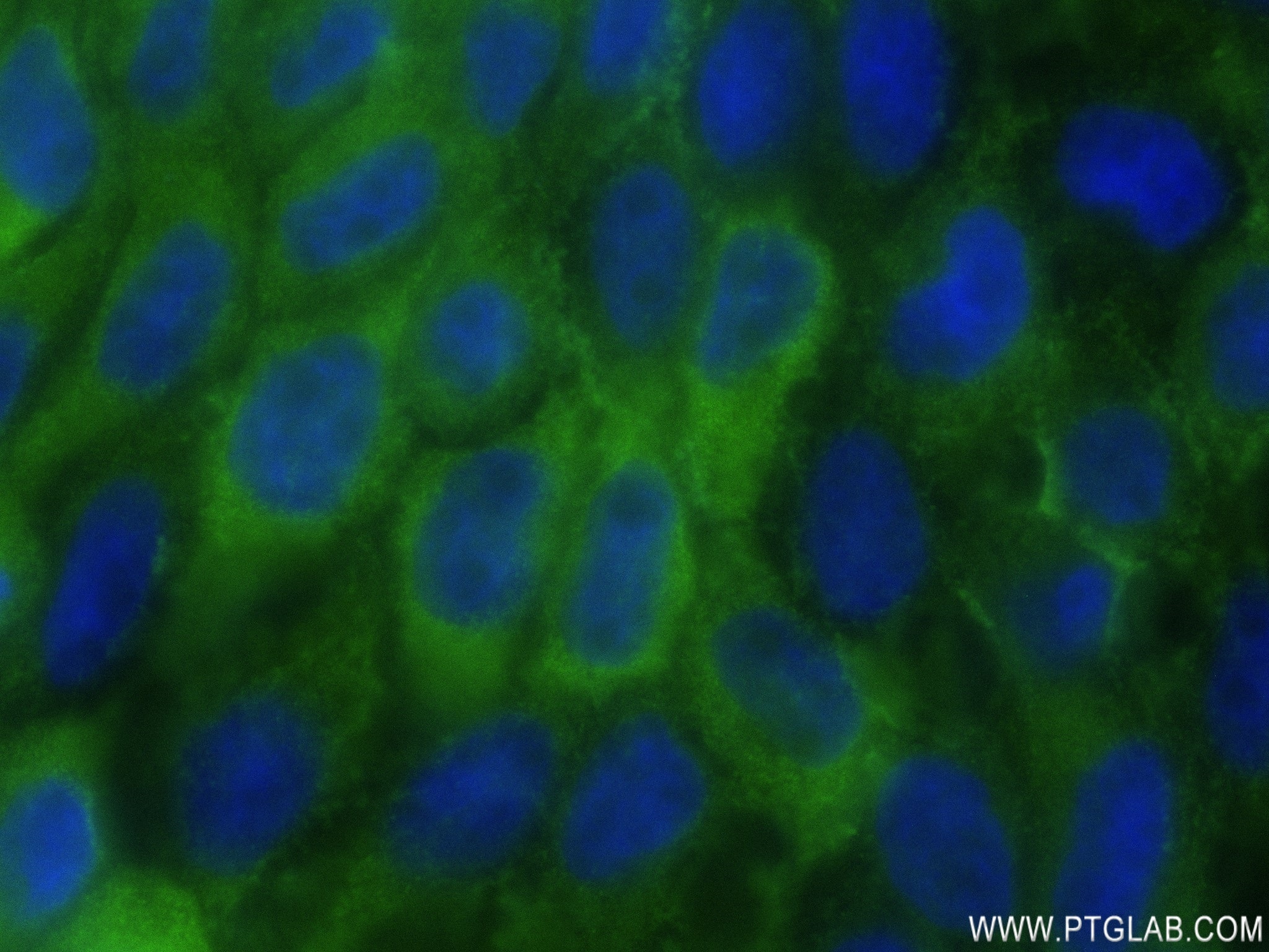 Immunofluorescence (IF) / fluorescent staining of A431 cells using DDX60 Recombinant antibody (82969-1-RR)