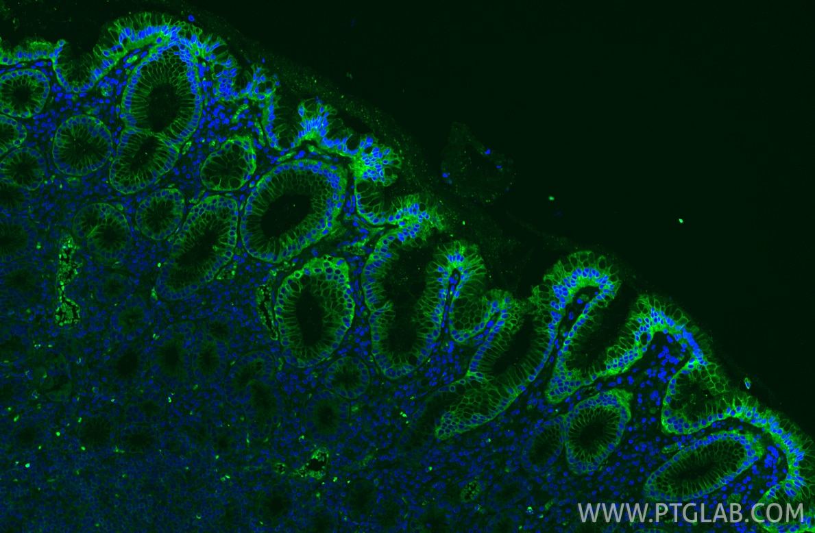 Immunofluorescence (IF) / fluorescent staining of human stomach tissue using DDX60 Recombinant antibody (82969-1-RR)