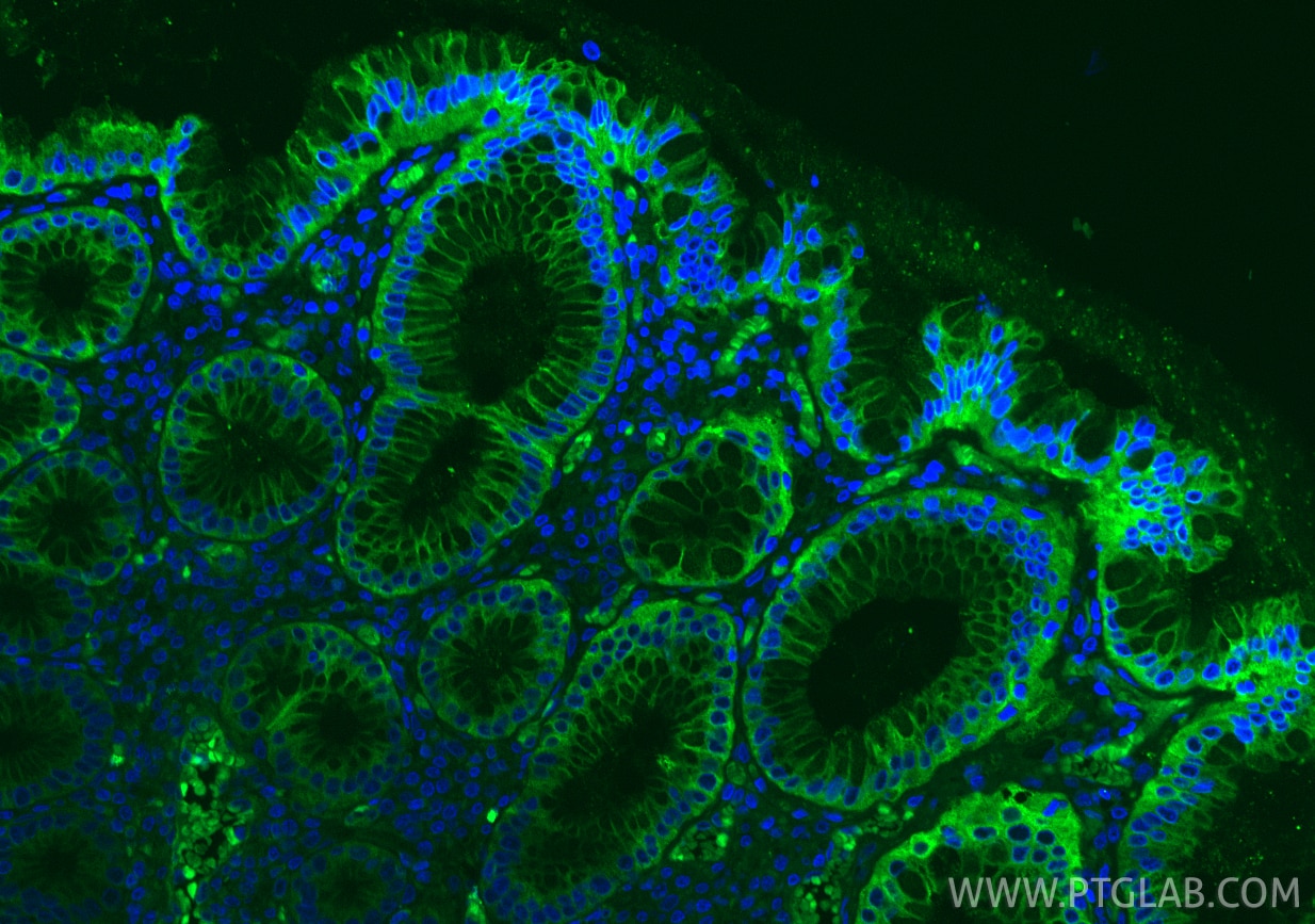 Immunofluorescence (IF) / fluorescent staining of human stomach tissue using DDX60 Recombinant antibody (82969-1-RR)