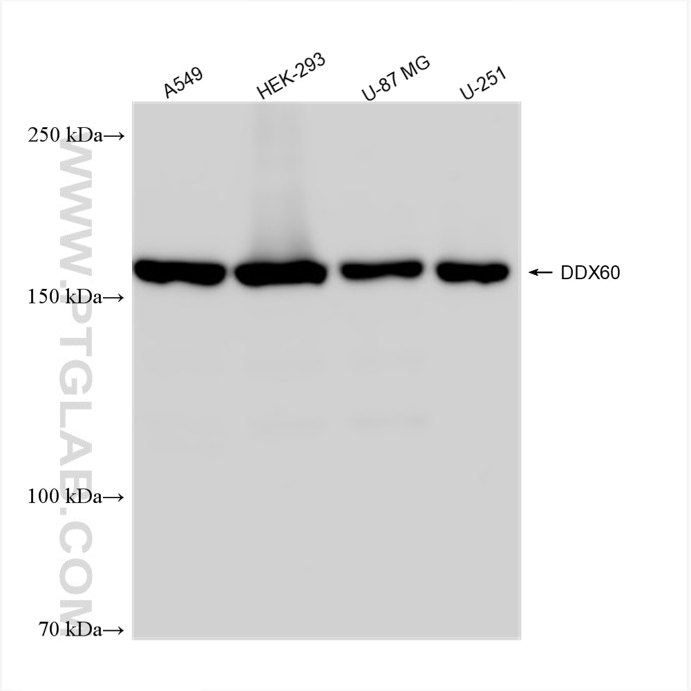 Western Blot (WB) analysis of various lysates using DDX60 Recombinant antibody (82969-1-RR)