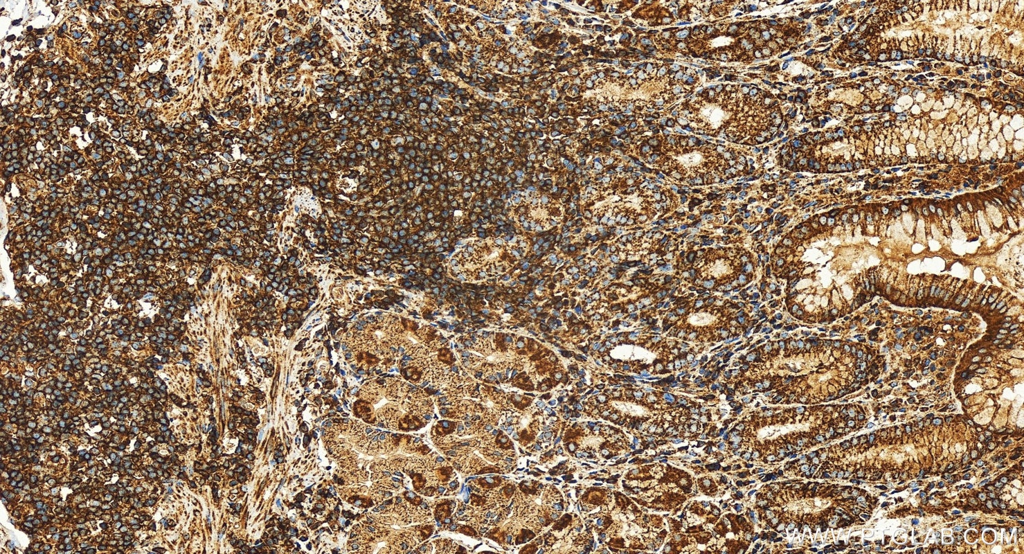 Immunohistochemistry (IHC) staining of human stomach tissue using DDX60 Recombinant antibody (82969-4-RR)