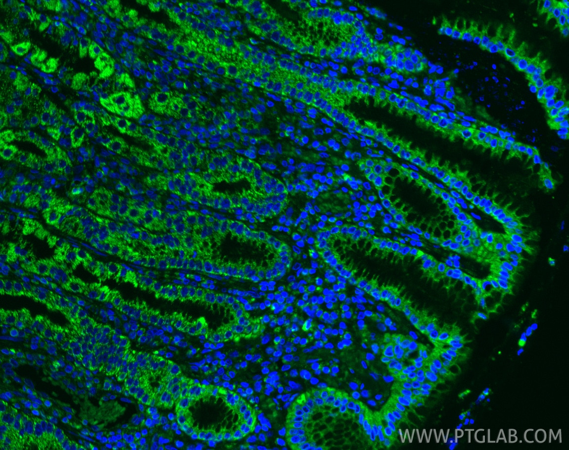 Immunofluorescence (IF) / fluorescent staining of human stomach tissue using DDX60 Recombinant antibody (82969-4-RR)