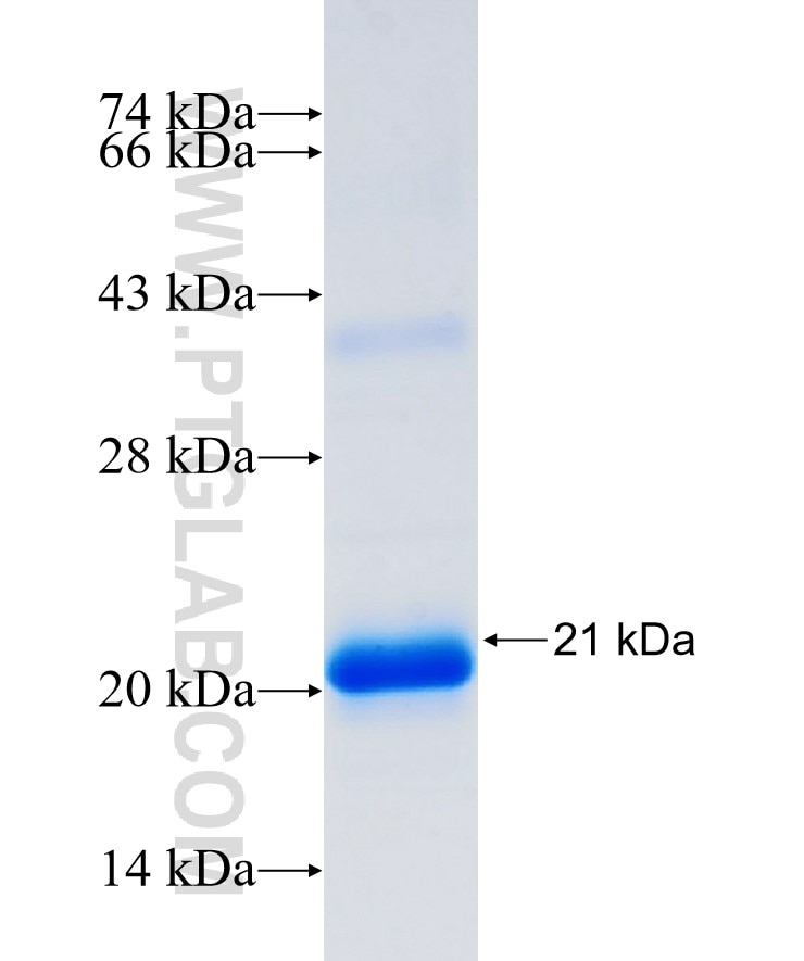 DDX60 fusion protein Ag34406 SDS-PAGE
