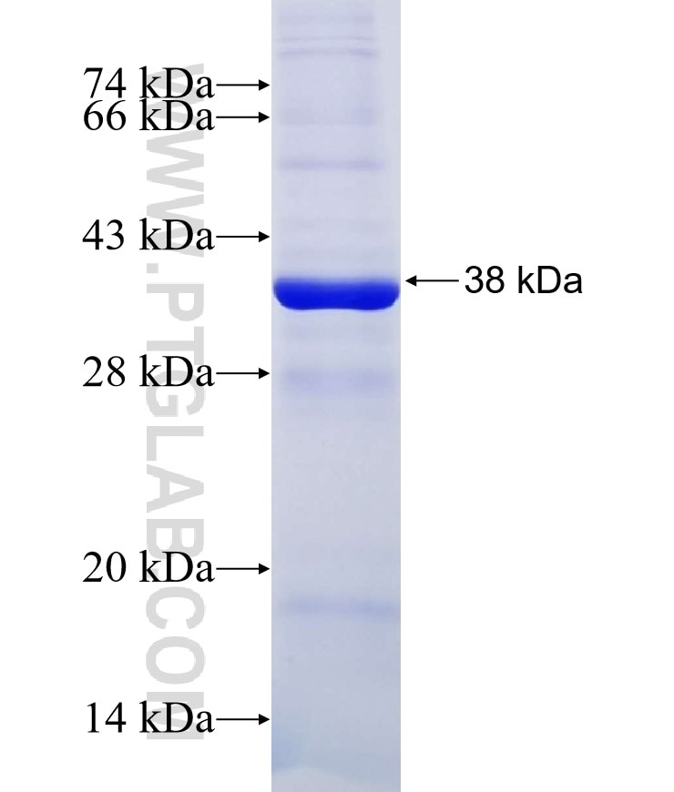 DDX60 fusion protein Ag17432 SDS-PAGE