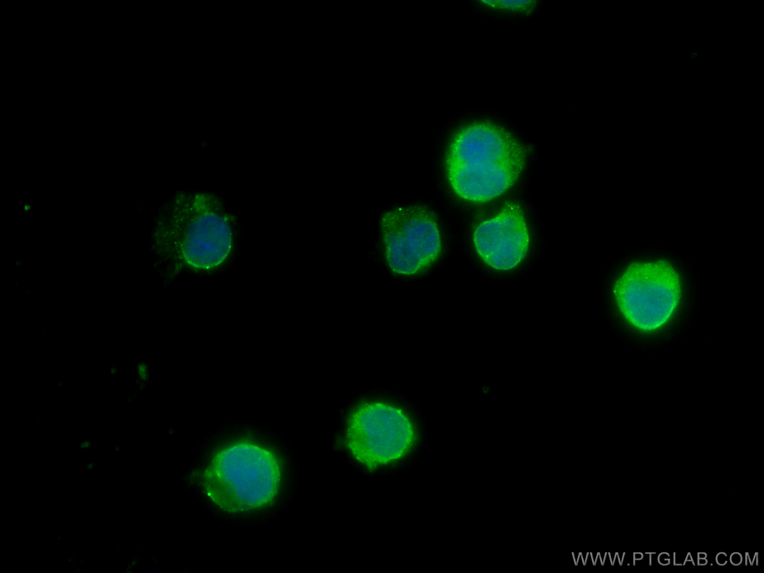 Immunofluorescence (IF) / fluorescent staining of Jurkat cells using DEAF1 Polyclonal antibody (18323-1-AP)
