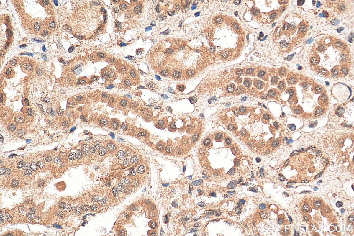 Immunohistochemistry (IHC) staining of human kidney tissue using DEAF1 Polyclonal antibody (18323-1-AP)