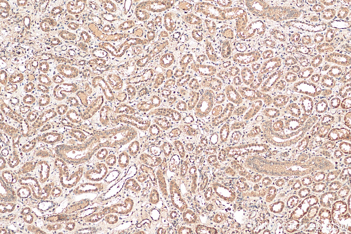 Immunohistochemistry (IHC) staining of human kidney tissue using DEAF1 Polyclonal antibody (18323-1-AP)