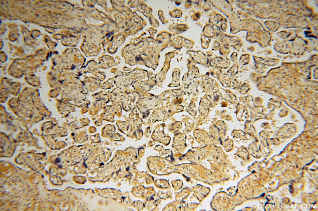 Immunohistochemistry (IHC) staining of human placenta tissue using DEAF1 Polyclonal antibody (18323-1-AP)