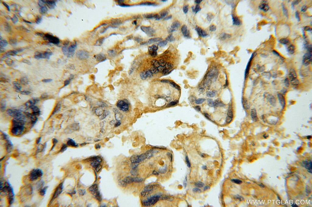 Immunohistochemistry (IHC) staining of human placenta tissue using DEAF1 Polyclonal antibody (18323-1-AP)