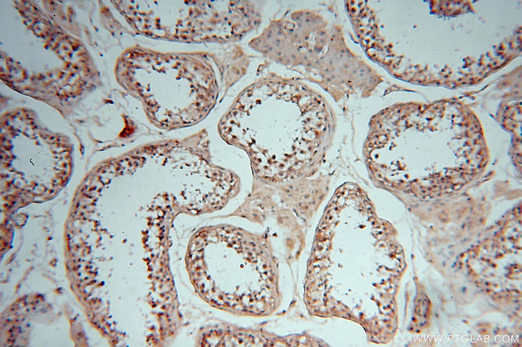 Immunohistochemistry (IHC) staining of human testis tissue using DEAF1 Polyclonal antibody (18323-1-AP)